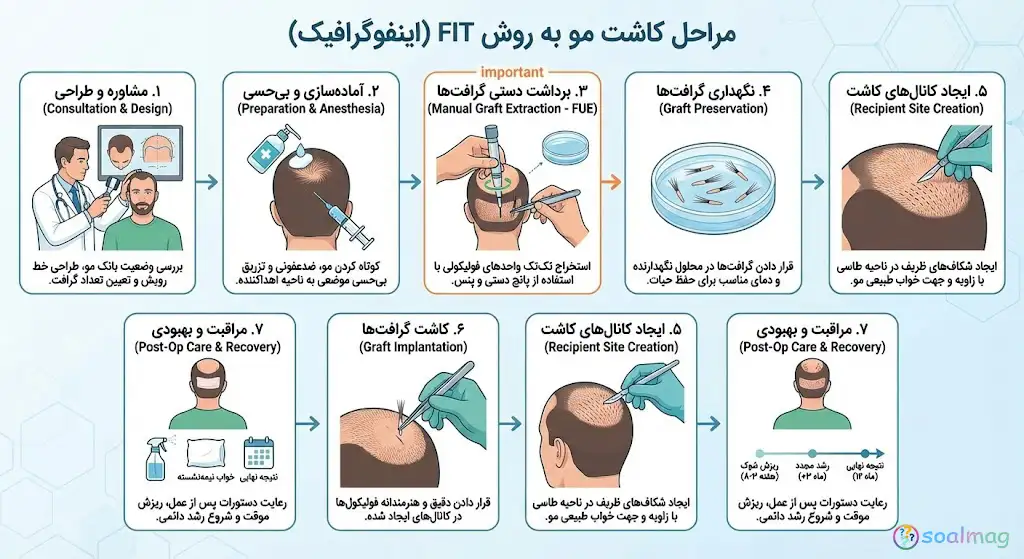 روش کاشت مو FIT چیست؟