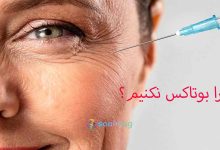 چرا بوتاکس نکنیم