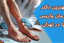 بهترین دکتر درمان واریس پا در تهران