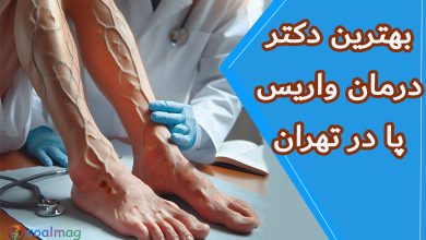 بهترین دکتر درمان واریس پا در تهران