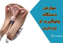 عوارض و خطرات دستگاه پیشگیری و جلوگیری از بارداری (IUD)