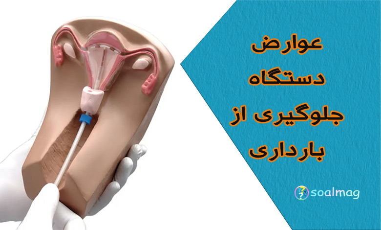 عوارض و خطرات دستگاه پیشگیری و جلوگیری از بارداری (IUD)