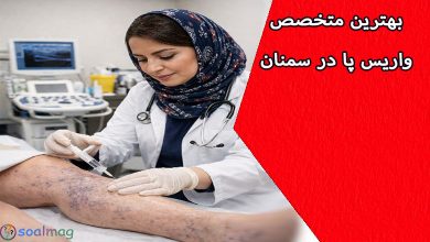 بهترین دکتر متخصص درمان واریس در سمنان