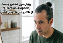 ریزش موی کششی چیست (Traction Alopecia): از علائم و علل تا درمان قطعی