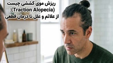 ریزش موی کششی چیست (Traction Alopecia): از علائم و علل تا درمان قطعی