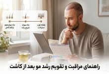 راهنمای جامع مراقبت های بعد از کاشت مو (روزشمار طلایی)