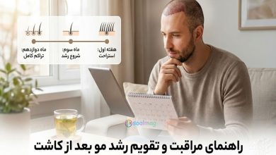 راهنمای جامع مراقبت های بعد از کاشت مو (روزشمار طلایی)
