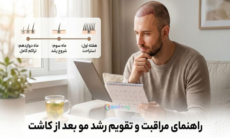 راهنمای جامع مراقبت های بعد از کاشت مو (روزشمار طلایی)