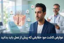 عوارض کاشت مو: حقایقی که پیش از عمل باید بدانید (راهنمای جامع)