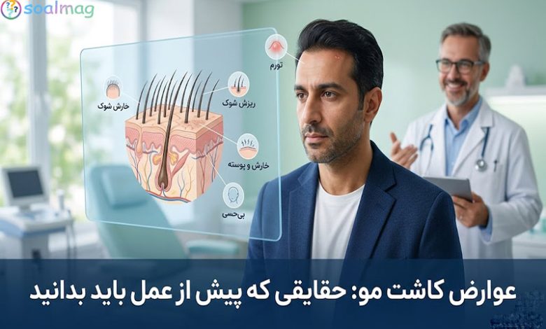 عوارض کاشت مو: حقایقی که پیش از عمل باید بدانید (راهنمای جامع)